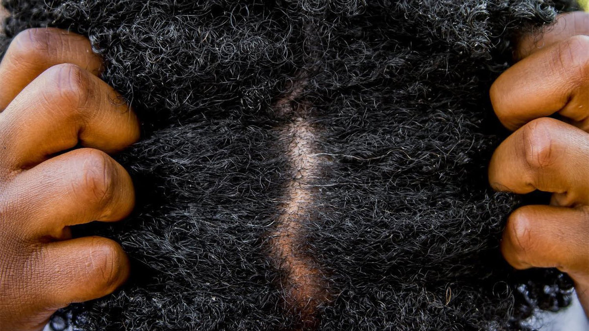a close up of a hairy black hair